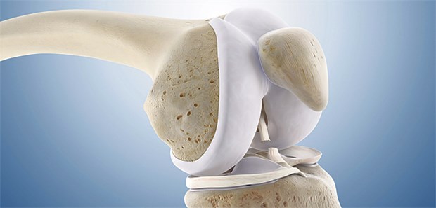 Stärkt Milch die Knorpel von Frauen? Eine Erhöhung des Milchkonsums um zehn Gläser pro Woche reduzierte ineiner Studie die Abnahme der Gelenkspaltweite um 0,06 mm.