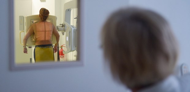 Offene Fragen zum ASV-Start Eine Frau wird geröntgt. Routineuntersuchung im Tuberkulose-Zentrum in Berlin.