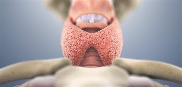 Eine Hashimoto-Thyreoiditis kann sich wahrscheinlich nur bei genetischer Disposition entwickeln.