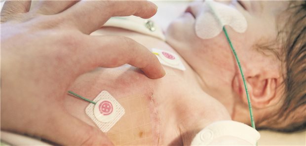 EIn Baby mit einer Narbe links neben der Brust liegt in einem Krankenhaus.