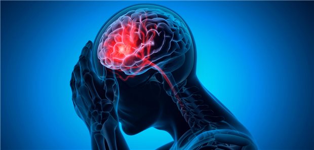 Eine Hyperoxie nach einem Schlaganfall führte dazu, dass die Patienten weniger Nebenwirkungen hatten.