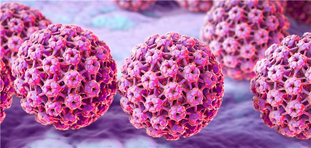 Eine Infektion mit humanen Papillomviren – meist vom Typ 6 und 11 – kann eine respiratorische Papillomatose verursachen.