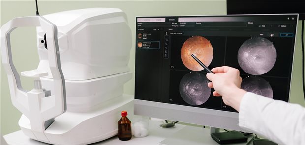 Retina-Scan-Analyse zur Untersuchung und Beurteilung der Makuladegeneration eines Patienten.