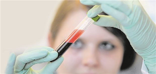 Kritik am GBA-Beschluss: „NIPT-Test hat keinen medizinischen Nutzen“ Eine Mitarbeiterin des Unternehmens Lifecodexx überprüft die Blutprobe einer schwangeren Frau. Der Gemeinsame Bundesausschuss hat den letzten Schritt für die Aufnahme von nicht-invasiven pränatalen Bluttests in den GKV-Leistungskatalog absolviert.