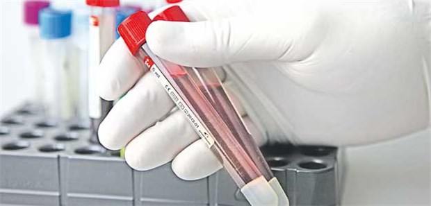 AML, CLL oder HIV? Eine Neutropenie im Blutbild sollte Ärzte hellhörig machen.