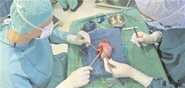 Lebendspende breiter aufstellen Eine Nierentransplantation: Bundesgesundheitsminister Spahn denkt darüber nach, Lebendspenden zu liberalisieren.