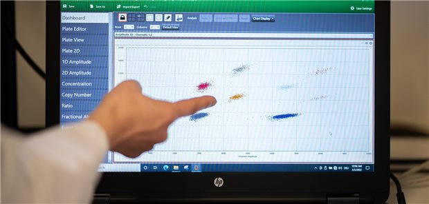 NRW nimmt Abwassermonitoring als Indikator auf Eine Probenauswertung einer Abwasserprobe mit Nachweisen auf Virusgene des SARS-CoV-2 Virus sind in einem Labor auf einem Monitor zu sehen. Nordrhein-Westfalen greift auf diesen zusätzlichen Indikator zurück, um die Infektionsdynamik zu beobachten.