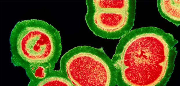 Jeder fünfte Mensch stirbt an einer Sepsis Eine Sepsis kann durch eine Vielzahl verschiedener Erreger ausgelöst werden, etwa durch Staphylococcus aureus.