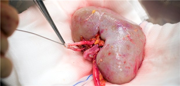 Mögliche Marker für Abstoßungsreaktion entdeckt Eine Spenderniere wird für die Transplantation vorbereitet.