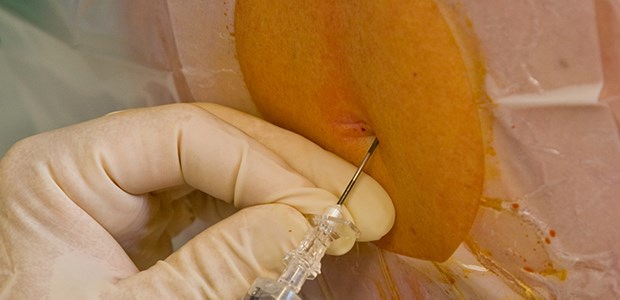 Toter Patient beschäftigt Ermittler Eine Spitze in den Rücken (hier ein Archivbild einer PDA) wurde einem Patienten in Österreich zum Verhängnis.
