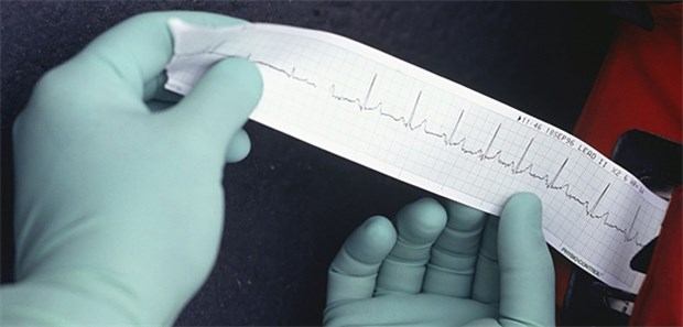 Eine Studio spricht Rofecoxib vom Verdacht auf kardiovaskuläre Schadwirkungen frei.