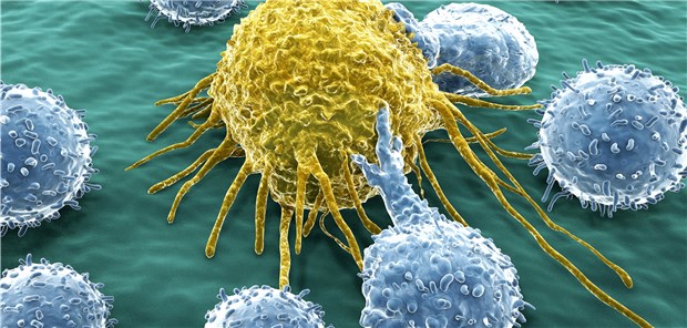 Eine T-Zelle (blau) greift eine Krebszelle an.