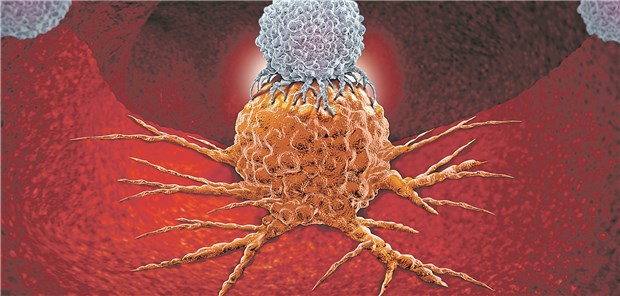 Eine T-Zelle (blau) richtet sich gegen eine Krebszelle .