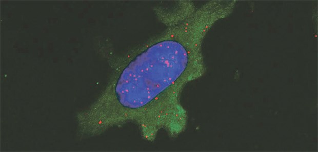 Neue Methode prüft Wirksamkeit von Krebs-Impfungen Eine Tumorzelle präsentiert das Krebs-Antigen auf ihrer Oberfläche: Die roten Punkte zeigen an, wo MHC-Moleküle das Tumorantigen gebunden haben.