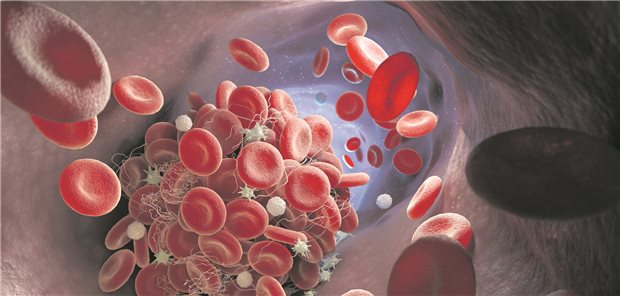 Eine antithrombotische Behandlung tut not: Was ist bei Älteren die beste Lösung?