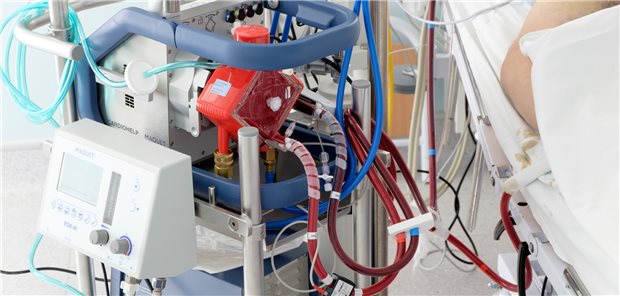 Eine extrakorporale Herz-Lungen-Maschine kann Leben retten. Knackpunkt: Ohne den Einsatz von PFAS können solche Maschinen nicht hergestellt werden, warnen zwei deutsche MedTech-Verbände.