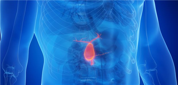 Eine frühe Entfernung der Gallenblase ist auch bei älteren Patienten sicher. Das hat eine Studie aus Sydney ergeben.