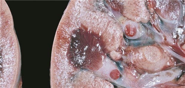 Was hat die interstitielle Nephritis ausgelöst? Modell eines aktuten Nierenversagens