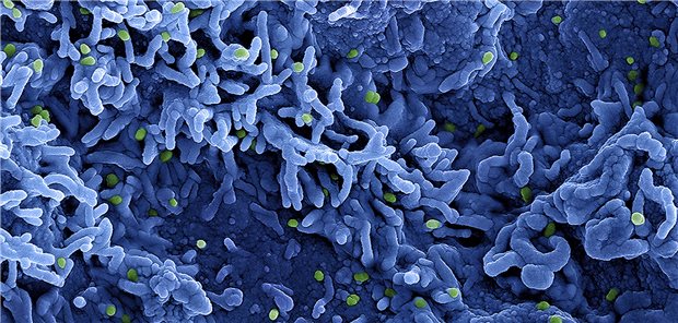 Eine kolorierte rasterelektronenmikroskopische Aufnahme des Affenpockenvirus (grün) auf der Oberfläche von infizierten Zellen (blau).