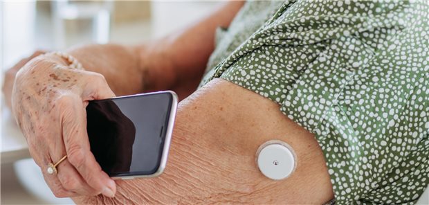 Eine kontinuierliche Glukoseüberwachung wirkt sich positiv auf die Augengesundheit aus: In einer Studie war die CGM-Nutzung mit einem niedrigeren Retinopathie-Risiko bei Personen mit Typ-1-Diabetes assoziiert.