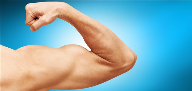 Eine massive Ausbuchtung am Oberarm infolge einer Bizepssehnenruptur kann ein frühes Zeichen einer Wildtyp-Transthyretin-Amyloidose sein.