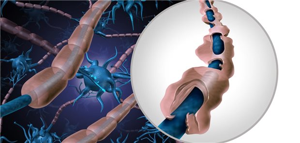 Mit Ublituximab mehr Chancen bei schubförmiger Multipler Sklerose Eine neue Option zur MS-Therapie bietet der durch Glykoengineering modifizierte Anti-CD20-Antikörper Ublituximab.