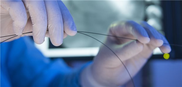 Eine perkutante Koronarintervention (PCI) mittels Katheter (mit oder ohne Stent) ist bei einem Mykardinfarkt in der Regel immer indiziert.