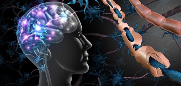 Dreidimensionale Darstellung des durch Multiple Sklerose geschädigtes Myelin und der dadurch freigelegte gesunde Nerv.