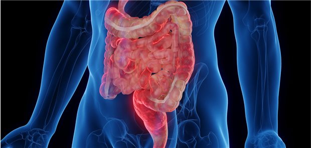 Eine pulmonale Beteiligung bei Patienten mit chronisch-entzündlichen Darmerkrankungen (CED) kann sich mit Stridor, Husten, Dyspnoe und Auswurf manifestieren. Sie zeigt in der Lungenfunktionsprüfung meist ein obstruktives Muster.