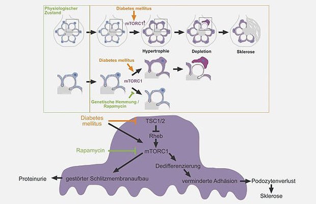 Eine überschießende mTOR-Aktivierung trägt maßgeblich zum Verlust der Nierenfunktion bei.