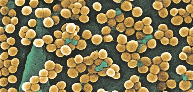 Eine veränderte kutane Staphylokokken-Besiedelung ist einer Studie zufolge in Anhaltspunkt, der auf eine Komplikation nach einer HSZT hinweist.