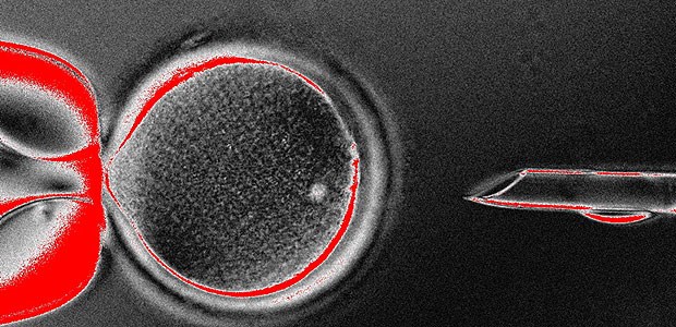 Menschliche Stammzellen aus geklontem Embryo Eine weibliche Eizelle wird zum Klonen präpariert.