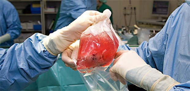 Von Spanien lernen! Eine zur Transplantation entnommene Spender-Niere wird verpackt.