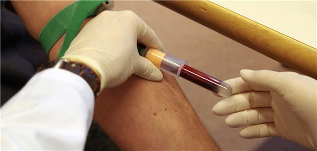 Einem Forschungsteam der Uni Kiel ist es gelungen, Parkinson-Patienten mittels Blutuntersuchung zu identifizieren.
