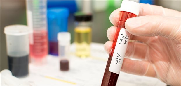 Einen Bestätigungstest holte sich einer Studie zufolge etwa eine von 300 Personen, die einen Suchtest in Anspruch genommen hatte.