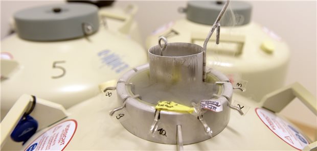 Einfrieren nicht nur von Eizellen, sondern auch von Ovarialgewebe: Ob das Krankenkassen auch jungen Mädchen zahlen müssen, entscheidet der G-BA.
