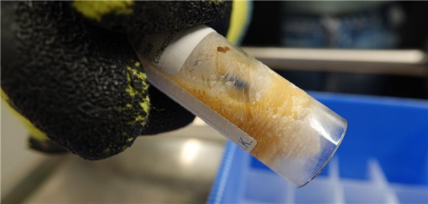 Eingefrorene Stuhlprobe in einem Gläschen. Wissenschaftler in Zürich bauen eine Sammlung für Darmbakterien aus aller Welt auf.