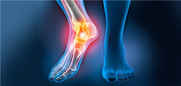 Eingespielte anatomische Strukturen: das Sprunggelenk. Forschende sind bestrebt, die Therapie bei Frakturen in diesem Bereich zu optimieren.