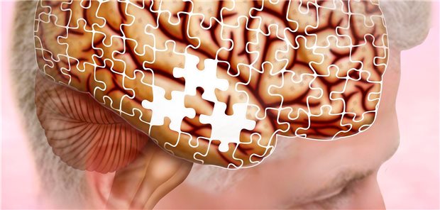 Gehirn mit subjektiv wahrgenommenen Gedächtnisproblemen.