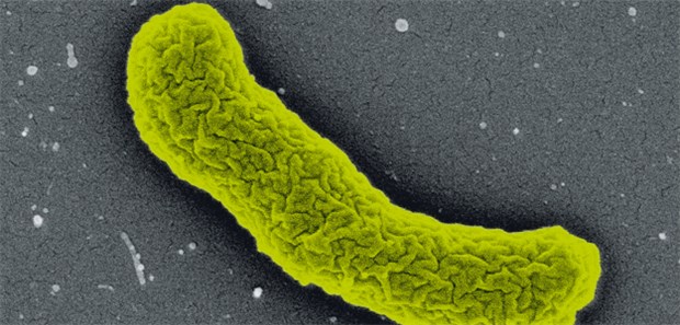 Das Problem mit Resistenzen bleibt Elefhtheria terrae: So sieht der Teixobactin-Produzent unter dem Elektronenmikroskop aus.