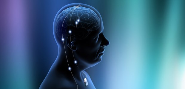Hirnstimulation auch für junge Patienten Elektroden am Kopf.