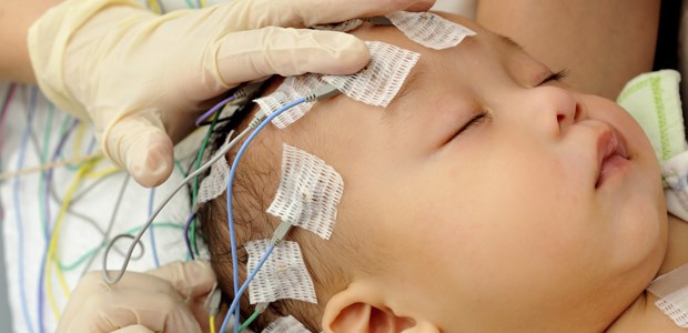 Schwere Krämpfe schaden Babys' Gehirn Elektroencephalogramm bei einem Kleinkind. Auch ein fieberbedingter Status epilepticus geht mit Entwicklungsverzögerungen einher.