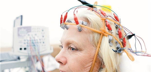 Elektroenzephalographie: Bei fokaler Epilepsie lohnt sich eine frühe Op.