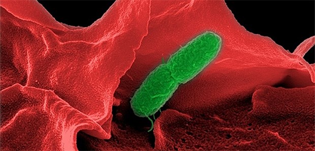 Mit Salmonellen Tumoren zerstören Elektronenmikroskop-Aufnahme von Salmonella enterica: Mit dem Bakterium planen Forscher, Tumoren zu bekämpfen