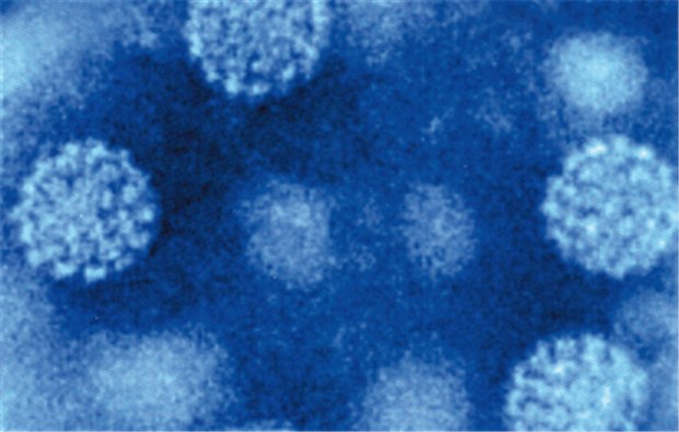 Durch frühen HPV-Nachweis lässt sich invasives Zervix-Ca verhindern Elektronenmikroskopie-Aufnahme von humanen Papilloma-Viren.