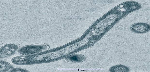 Resistente TB-Erreger breiten sich in Asien aus Elektronenmikroskopische Aufnahme des Tuberkulose-Erregers Mycobacterium tuberculosis.
