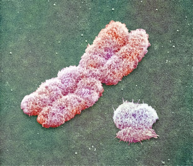 Medizin-Nobelpreis für Zellforscher Elektronenmikroskopische Aufnahme des X-Chromosoms. An den Enden sitzen die Telomere.