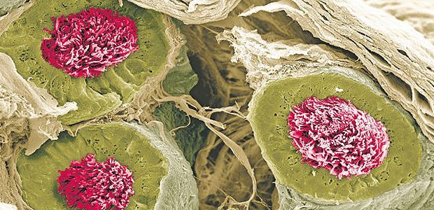 Elektronenmikroskopische Aufnahme reifender Spermien (pink) in der Epididymis (grün). FSH verbessert die Spermienqualität.