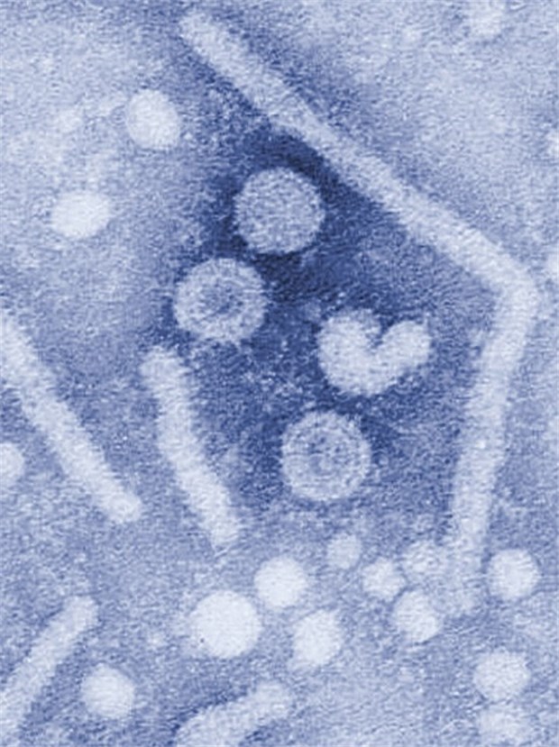 Resistenz bei neuer HBV-Therapie selten Elektronenmikroskopische Aufnahme von Hepatitis-B-Viren. Entscheidend für den Therapie-Erfolg ist die dauerhafte Virussuppression.