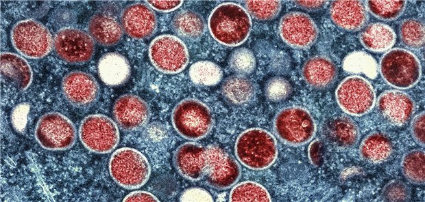 WHO-Chef beruft Notfallausschuss wegen Mpox ein Elektronenmikroskopische Aufnahme von Mpox-Partikeln in einer infizierten Zelle.